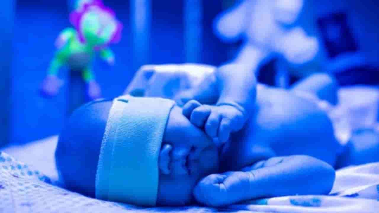 ನವಜಾತ ಶಿಶುಗಳಿಗೆ ಕಾಮಾಲೆ ಏಕೆ ಬರುತ್ತದೆ? ಇಲ್ಲಿದೆ ಕಾರಣ