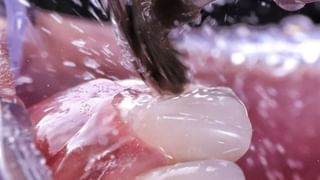 Walnuts vs Almonds: ಮೆದುಳಿನ ಆರೋಗ್ಯ ಕಾಪಾಡಲು ವಾಲ್ನಟ್, ಬಾದಾಮಿ ಇವುಗಳಲ್ಲಿ ಯಾವುದು ಒಳ್ಳೆಯದು ತಿಳಿದುಕೊಳ್ಳಿ