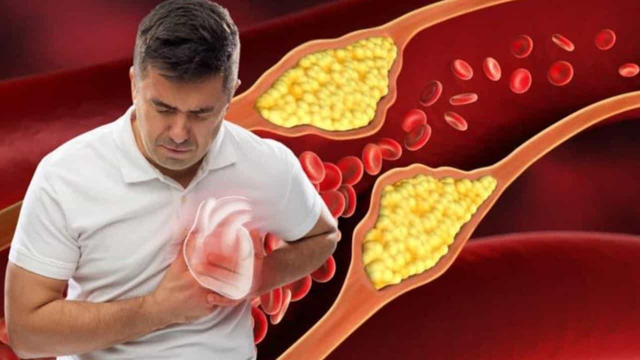 Health Tips: ಅಧಿಕ ಕೊಲೆಸ್ಟ್ರಾಲ್ ಹೃದಯದ ಆರೋಗ್ಯಕ್ಕೆ ಅಪಾಯಕಾರಿ Health Tips: ಅಧಿಕ ಕೊಲೆಸ್ಟ್ರಾಲ್ ಹೃದಯದ ಆರೋಗ್ಯಕ್ಕೆ ಅಪಾಯಕಾರಿ