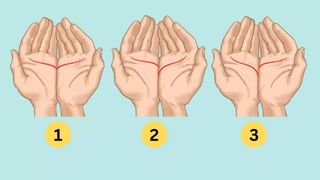 Skin Care Tips : ಮೊಡವೆ ಸಮಸ್ಯೆಗೆ ಈ ಹಣ್ಣಿನ ಬೀಜದಲ್ಲಿದೆ ಸುಲಭ ಪರಿಹಾರ