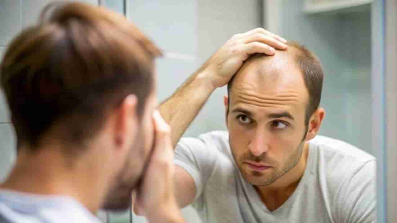 Hair Care: ಬೋಳು ತಲೆಯಲ್ಲಿಯೂ ಚಿಗುರುತ್ತೆ ಕೂದಲು, ಇದನ್ನು ಹಚ್ಚಿ ನೋಡಿ