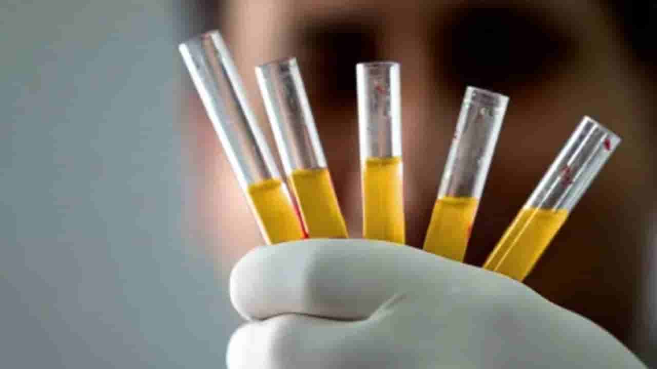 ಇದು ಚಿನ್ನದ ರಕ್ತ.. ಜಗತ್ತಿನಲ್ಲೇ ಅತ್ಯಂತ ಅಪರೂಪದ ರಕ್ತದ ಗುಂಪು ಯಾವುದು ಗೊತ್ತಾ?