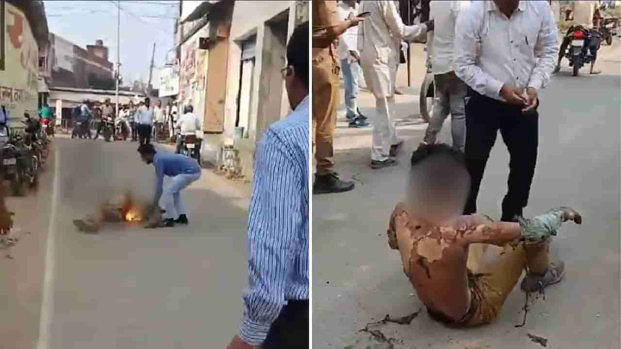 ಹೆಂಡತಿಯೊಂದಿಗೆ ಜಗಳವಾಡಿ ಬೆಂಕಿ ಹಚ್ಚಿಕೊಂಡ ಯುವಕ