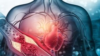 Thyroid Friendly Salt: ಥೈರಾಯ್ಡ್ ಸಮಸ್ಯೆ ಇರುವವರು ಯಾವ ಉಪ್ಪನ್ನು ತಿನ್ನಬೇಕು? ತಜ್ಞರು ನೀಡಿದ ಮಾಹಿತಿ ಇಲ್ಲಿದೆ