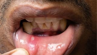 Curd Benefits: ಮಡಕೆಯಲ್ಲಿ ಇಟ್ಟ ಮೊಸರು ಹುಳಿ ಬರದಿರಲು ಕಾರಣವೇನು?