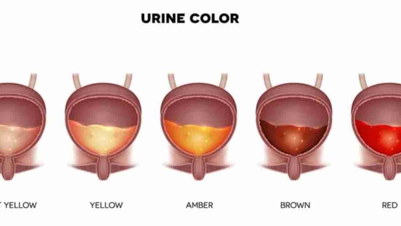 Urine Color Alert: ಮೂತ್ರದ ಬಣ್ಣದಿಂದ ನಿಮಗಿರುವ ಆರೋಗ್ಯ ಸಮಸ್ಯೆಯನ್ನು ತಿಳಿಯಬಹುದು