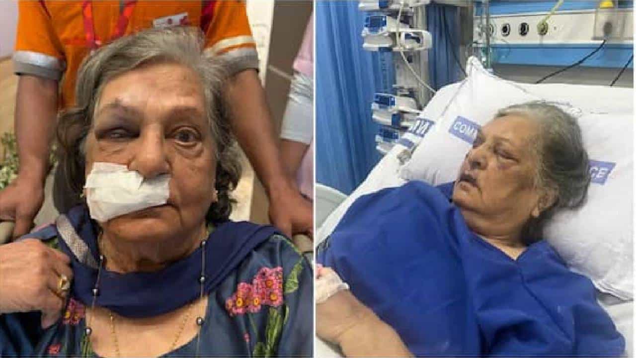 ದೆಹಲಿ: ಏರ್​ಪೋರ್ಟ್​ನಲ್ಲಿ ವ್ಹೀಲ್​ ಚೇರ್ ಕೊಡದ ಏರ್​ಇಂಡಿಯಾ, ಬಿದ್ದು ಐಸಿಯುಗೆ ದಾಖಲಾದ ವೃದ್ಧೆ