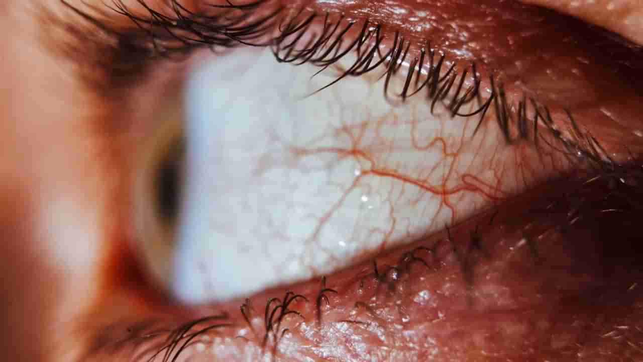 ಕಣ್ಣಿನಲ್ಲಿರುವ ರಕ್ತನಾಳಗಳ ಆರೋಗ್ಯ ಹೆಚ್ಚಿಸುತ್ತೆ ಈ ಆಹಾರಗಳು