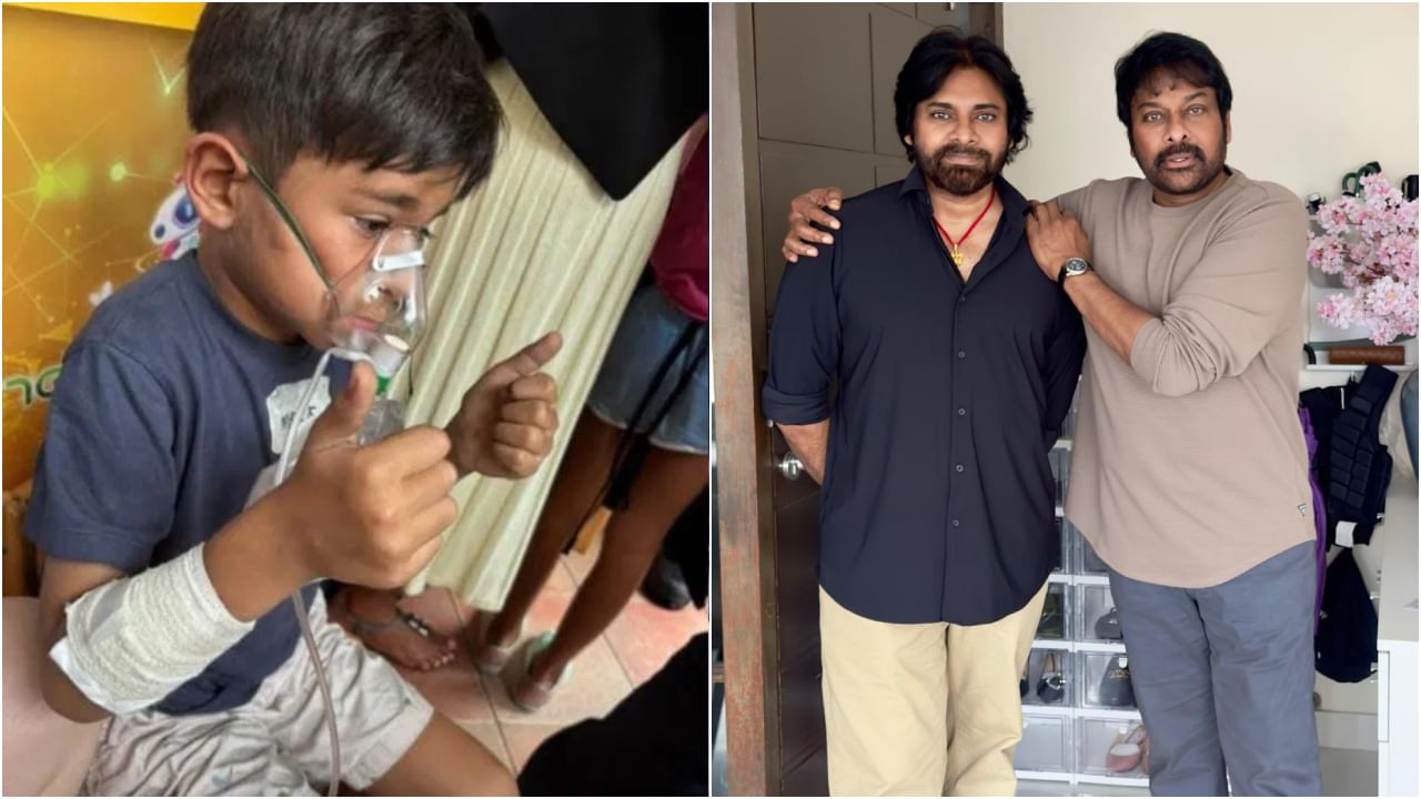 ಅಗ್ನಿ ಅವಘಡದ ಬಳಿಕ ಪವನ್ ಕಲ್ಯಾಣ್ ಮಗನ ಸ್ಥಿತಿ ಹೇಗಿದೆ? ಮಾಹಿತಿ ನೀಡಿದ ಚಿರಂಜೀವಿ