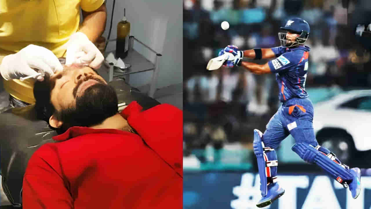 VIDEO: ನಿಕೋಲಸ್ ಪೂರನ್ ಸಿಕ್ಸರ್ಗೆ ಅಭಿಮಾನಿಯ ಹಣೆ ಓಪನ್