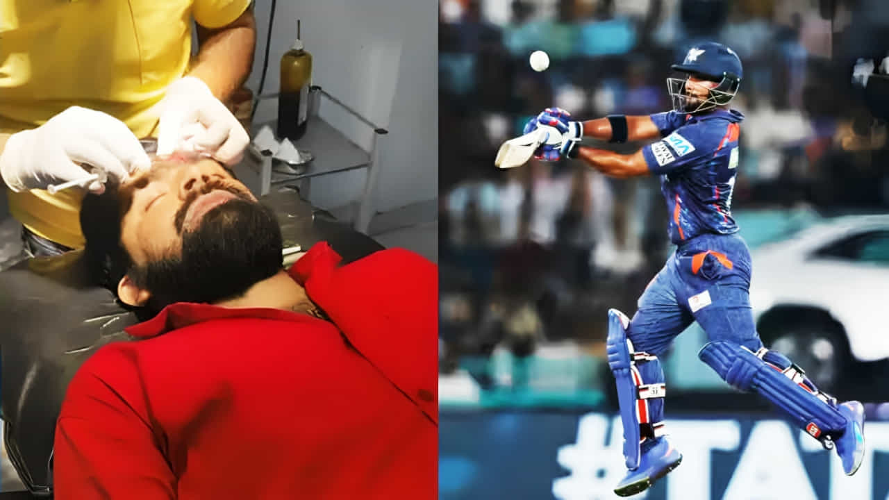 VIDEO: ನಿಕೋಲಸ್ ಪೂರನ್ ಸಿಕ್ಸರ್ಗೆ ಅಭಿಮಾನಿಯ ಹಣೆ ಓಪನ್ VIDEO: ನಿಕೋಲಸ್ ಪೂರನ್ ಸಿಕ್ಸರ್ಗೆ ಅಭಿಮಾನಿಯ ಹಣೆ ಓಪನ್