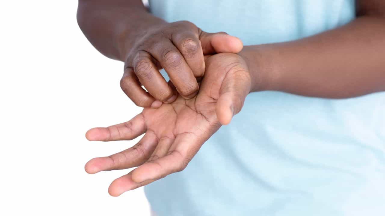 Palm Itching Causes: ಅಂಗೈನಲ್ಲಿ ಕಂಡುಬರುವ ತುರಿಕೆಯನ್ನು ನಿರ್ಲಕ್ಷಿಸಬೇಡಿ Palm Itching Causes: ಅಂಗೈನಲ್ಲಿ ಕಂಡುಬರುವ ತುರಿಕೆಯನ್ನು ನಿರ್ಲಕ್ಷಿಸಬೇಡಿ