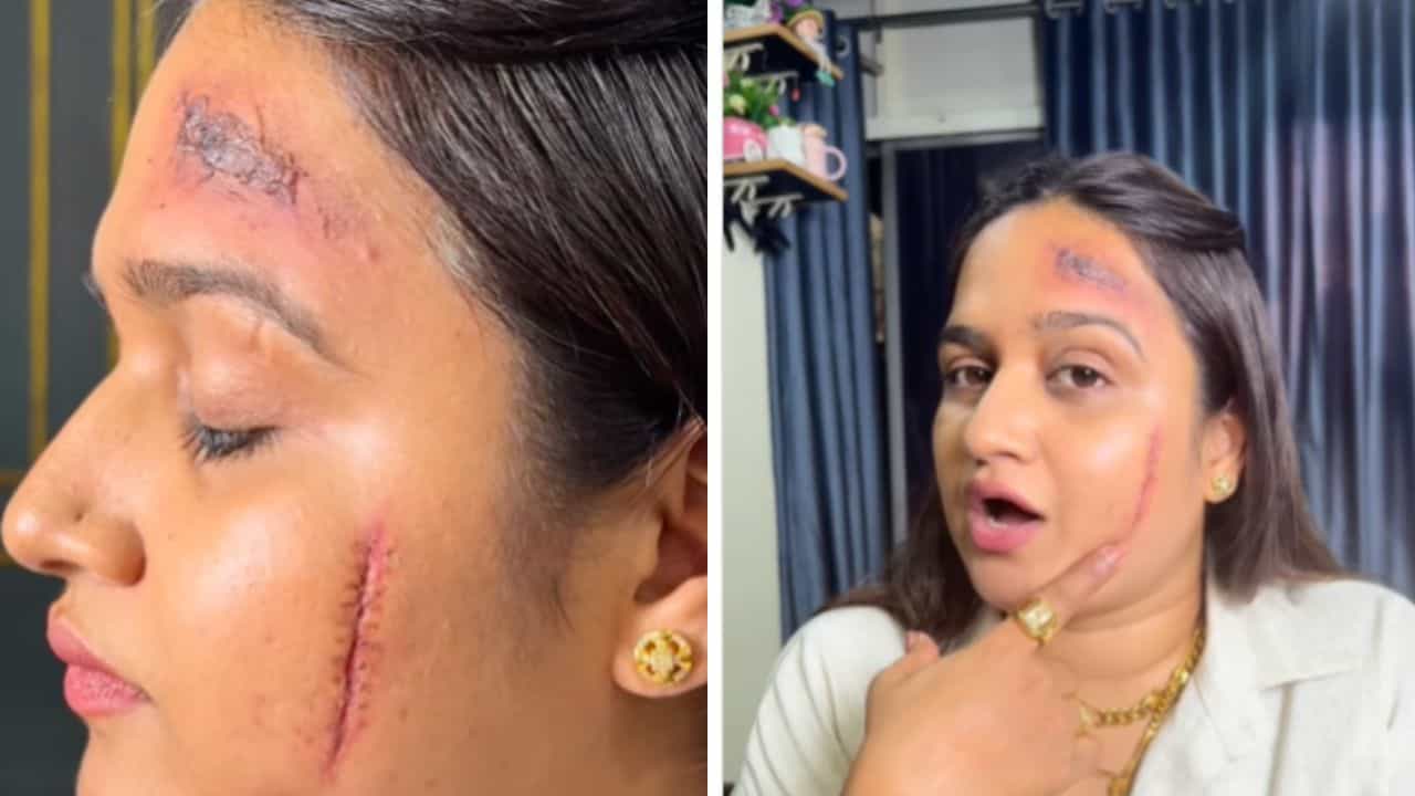 Viral: ನಕಲಿ ಗಾಯ ತೋರಿಸಿ ರಜೆ ತೆಗೆದುಕೊಳ್ಳಿ; ಸಿಕ್ ಲೀವ್‌ ಪಡೆಯಲು ಹೊಸ ಟ್ರಿಕ್ಸ್‌ ಹೇಳಿಕೊಟ್ಟ ಮೆಕಪ್‌ ಆರ್ಟಿಸ್ಟ್