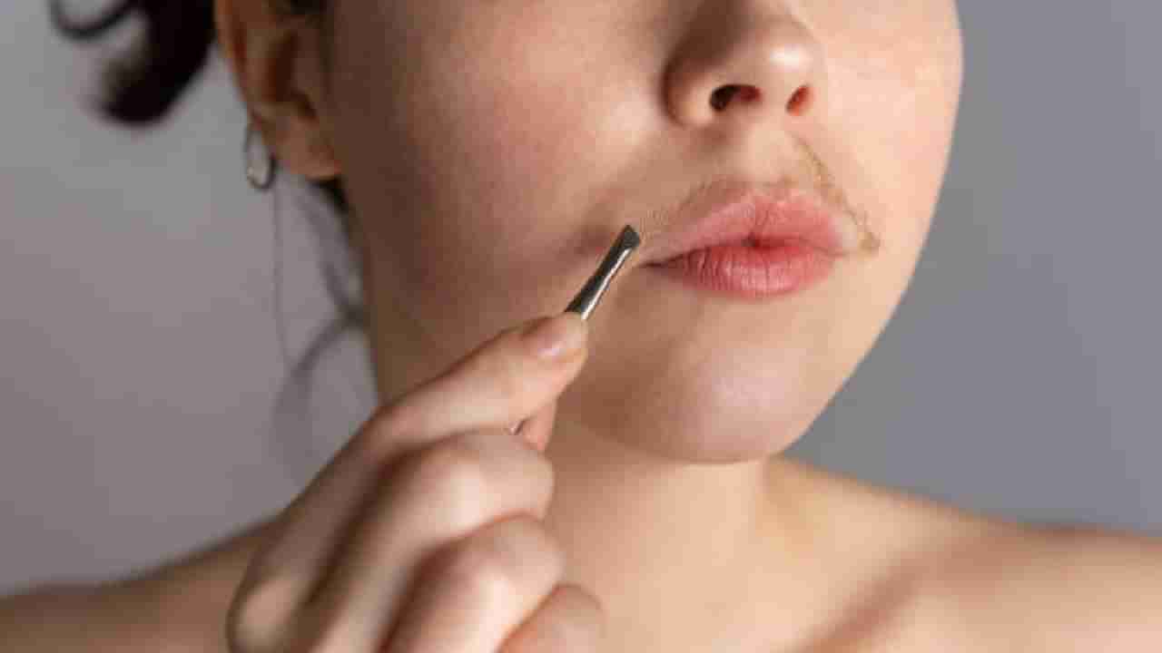 ಮಹಿಳೆಯರೇ… ಆಂಡ್ರೋಜೆನ್‌ ಹಾರ್ಮೋನ್‌ ಸಮಸ್ಯೆಯ ಬಗ್ಗೆ ನಿರ್ಲಕ್ಷ್ಯ ಬೇಡ್ವೇ ಬೇಡ