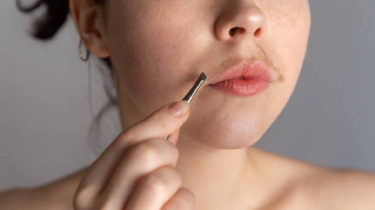 ಮಹಿಳೆಯರೇ… ಆಂಡ್ರೋಜೆನ್‌ ಹಾರ್ಮೋನ್‌ ಸಮಸ್ಯೆಯ ಬಗ್ಗೆ ನಿರ್ಲಕ್ಷ್ಯ ಬೇಡ್ವೇ ಬೇಡ