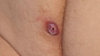 ರಕ್ತದೊತ್ತಡವನ್ನು ನೈಸರ್ಗಿಕವಾಗಿ ಕಡಿಮೆ ಮಾಡಲು ಹಾರ್ವರ್ಡ್ ವೈದ್ಯರು ತಿಳಿಸಿರುವ 5 ಆಹಾರಗಳು