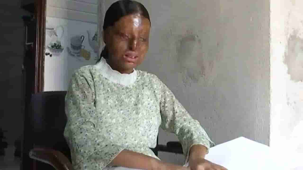 Meet Kafi: ಆಸಿಡ್ ದಾಳಿಯಲ್ಲಿ ದೃಷ್ಟಿ ಕಳೆದುಕೊಂಡ ವಿದ್ಯಾರ್ಥಿನಿಗೆ ಇಂದು PUCಯಲ್ಲಿ ಶೇ.95.6 ಅಂಕ