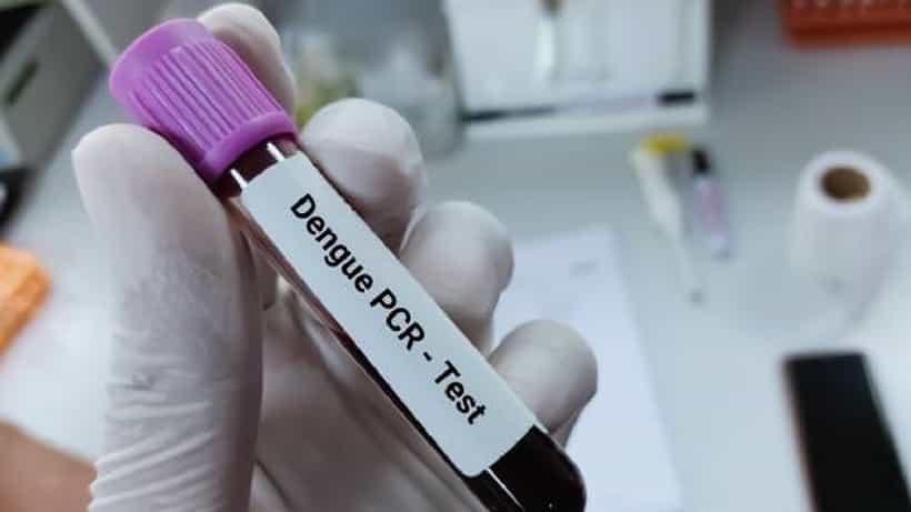 Dengue: ಕರ್ನಾಟಕದಲ್ಲಿ ಸಾವಿರದ ಗಡಿ ದಾಟಿದ ಡೆಂಘಿ ಪ್ರಕರಣ; ಪೋಷಕರೇ ಮಕ್ಕಳ ಬಗ್ಗೆ ಎಚ್ಚರ!