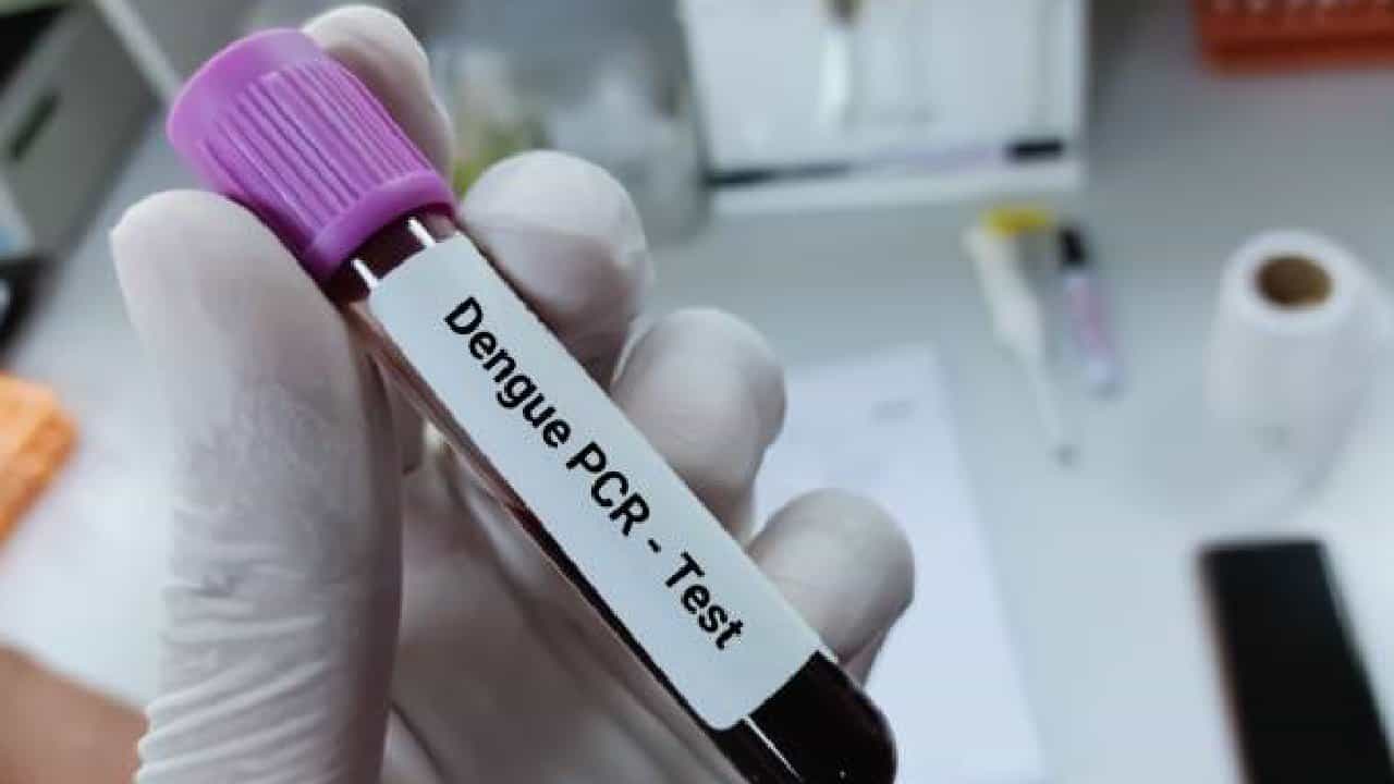 Dengue: ಕರ್ನಾಟಕದಲ್ಲಿ ಸಾವಿರದ ಗಡಿ ದಾಟಿದ ಡೆಂಘಿ ಪ್ರಕರಣ; ಪೋಷಕರೇ ಮಕ್ಕಳ ಬಗ್ಗೆ ಎಚ್ಚರ!