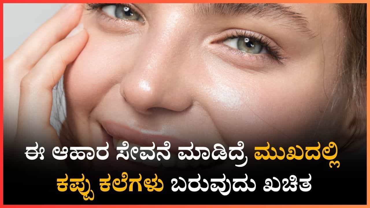 ಈ ಆಹಾರಗಳ ಸೇವನೆ ಮಾಡಿದರೆ ಮುಖದಲ್ಲಿ ಕಪ್ಪು ಕಲೆಗಳು ಬರುವುದು ಖಚಿತ