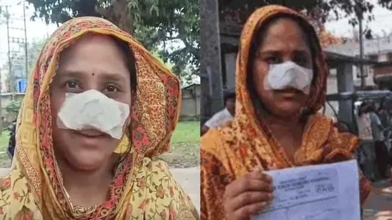 ನಿದ್ದೆಯಲ್ಲಿದ್ದಾಗಲೇ ಪತ್ನಿ ಮೂಗನ್ನೇ ಕಚ್ಚಿ ತಿಂದ ಪತಿ, ಇಲ್ಲಿದೆ ಅಸಲಿ ವಿಚಾರ