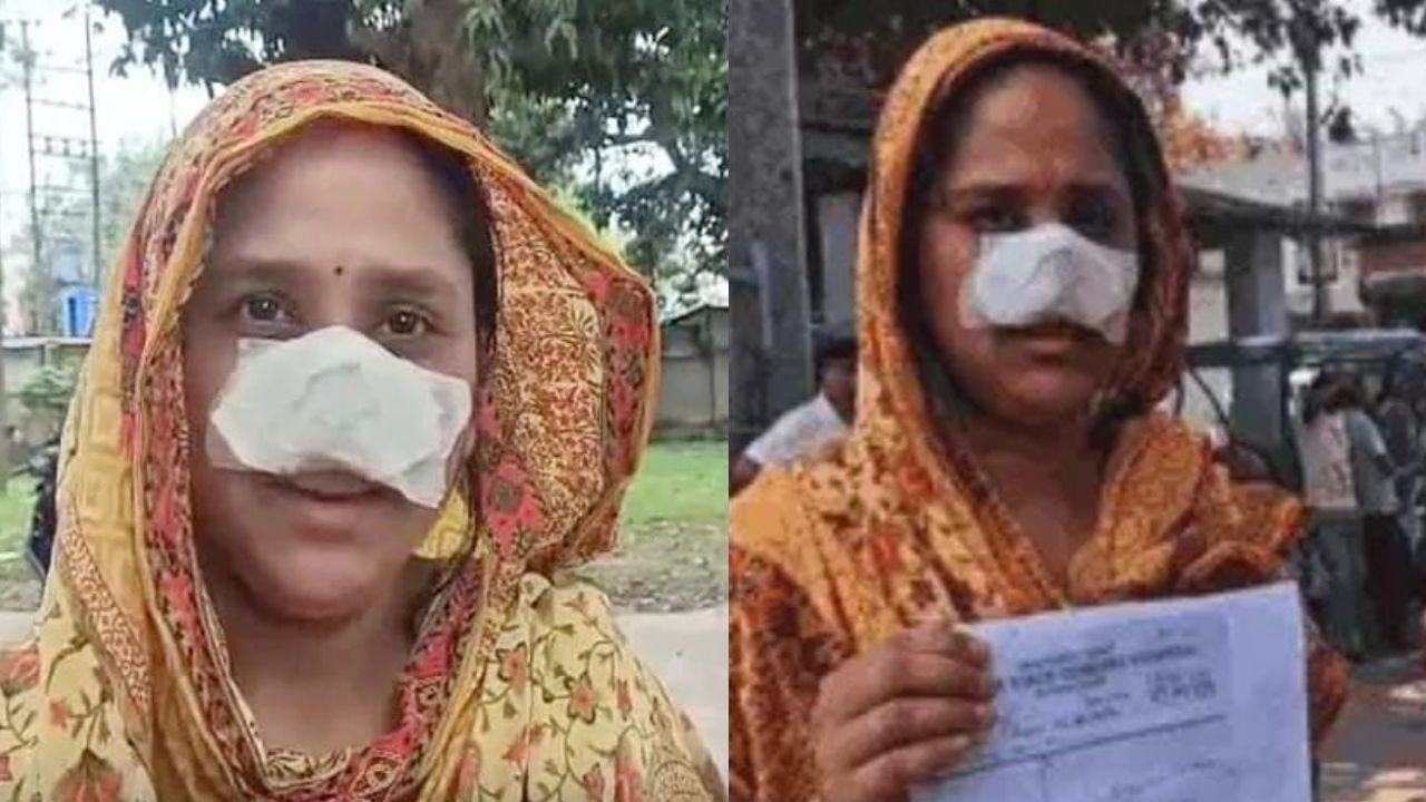 ನಿದ್ದೆಯಲ್ಲಿದ್ದಾಗಲೇ ಪತ್ನಿ ಮೂಗನ್ನೇ ಕಚ್ಚಿ ತಿಂದ ಪತಿ, ಇಲ್ಲಿದೆ ಅಸಲಿ ವಿಚಾರ