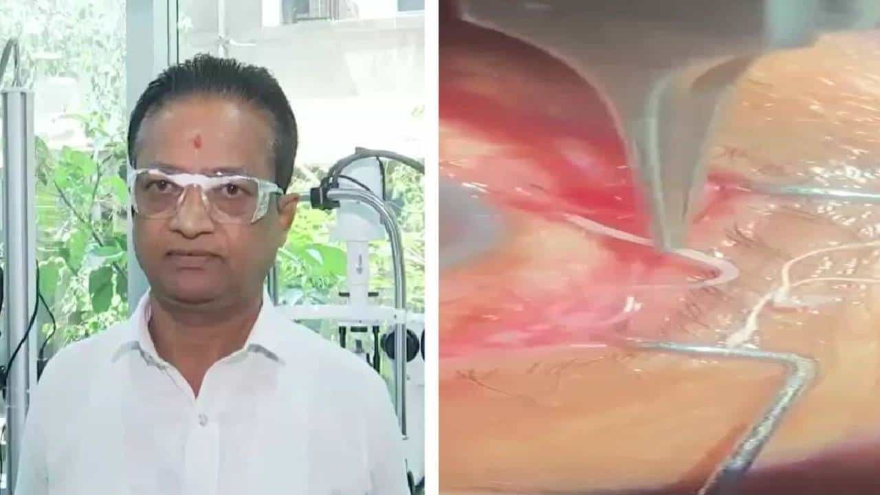 ಕಣ್ಣಿನಲ್ಲಿತ್ತು 10 ಸೆಂ.ಮೀ ಉದ್ದದ ಹುಳು, ಶಸ್ತ್ರ ಚಿಕಿತ್ಸೆ ಮೂಲಕ ಹೊರ ತೆಗೆದ ವೈದ್ಯರು
