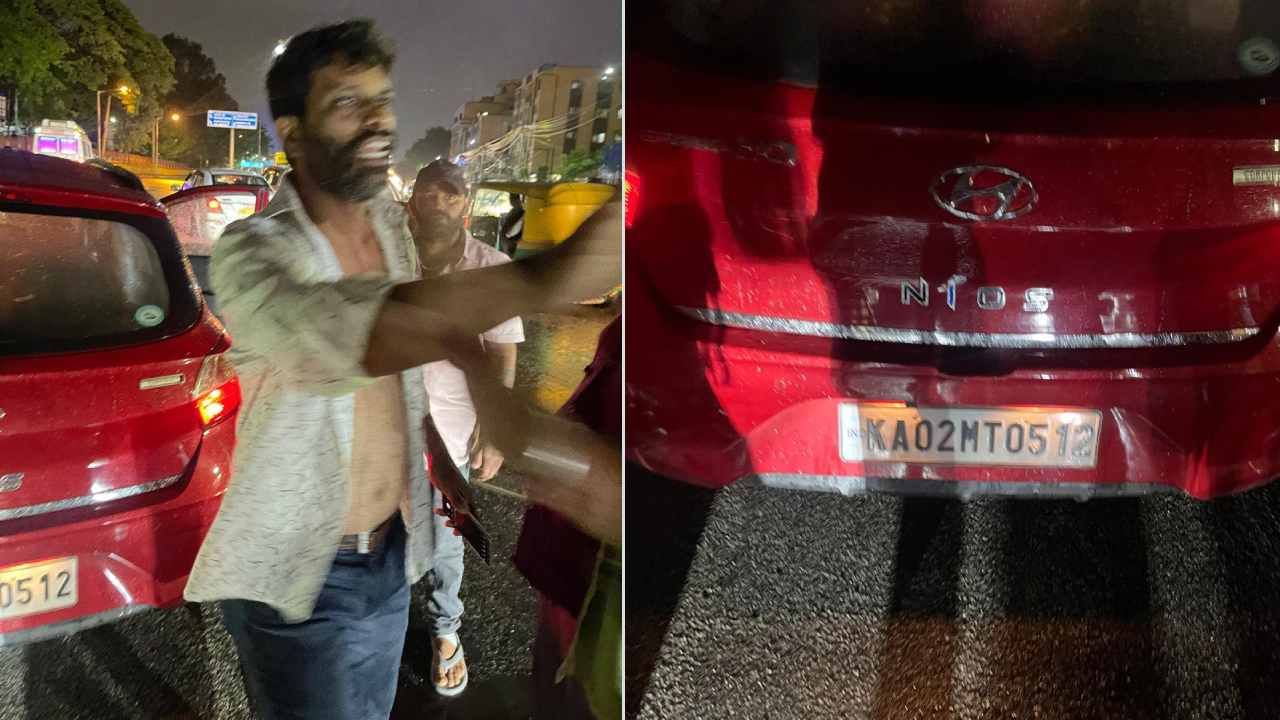 ಬೆಂಗಳೂರು: ಕಾರಿಗೆ ಮಳೆ ನೀರು ಹಾರಿದ್ದಕ್ಕೆ ಮಾಂಸ ಹೊರಬರುವಂತೆ ಬೆರಳು ಕಚ್ಚಿ ವಿಕೃತಿ ಮೆರೆದ ವ್ಯಕ್ತಿ ಬೆಂಗಳೂರು: ಕಾರಿಗೆ ಮಳೆ ನೀರು ಹಾರಿದ್ದಕ್ಕೆ ಮಾಂಸ ಹೊರಬರುವಂತೆ ಬೆರಳು ಕಚ್ಚಿ ವಿಕೃತಿ ಮೆರೆದ ವ್ಯಕ್ತಿ