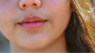 Dental Health: ಹೊಸ ಹಲ್ಲುಗಳಿಗಾಗಿ ದಂತ ಕೋಶಕ್ಕೆ ಕಸಿ ಪ್ರಯೋಗ, ಡೆಂಟಲ್ ಫಿಲ್ಲಿಂಗ್ ಮಾಡುವ ಅವಶ್ಯಕತೆ ಇಲ್ಲ