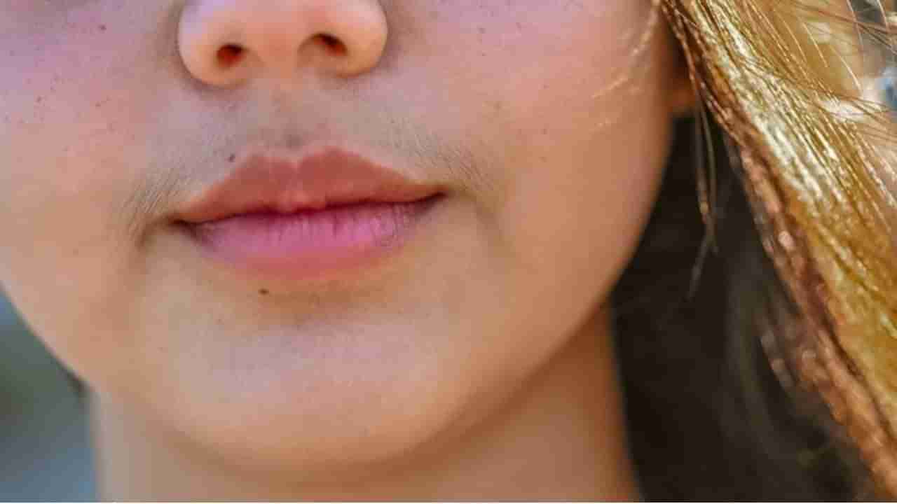 ಹುಡುಗರಂತೆ ಗಡ್ಡ, ಮೀಸೆ ಬರುತ್ತಾ? ಈ ಸಮಸ್ಯೆ ತಡೆಯಲು ಇಲ್ಲಿದೆ ವೈದ್ಯರ ಸಲಹೆ