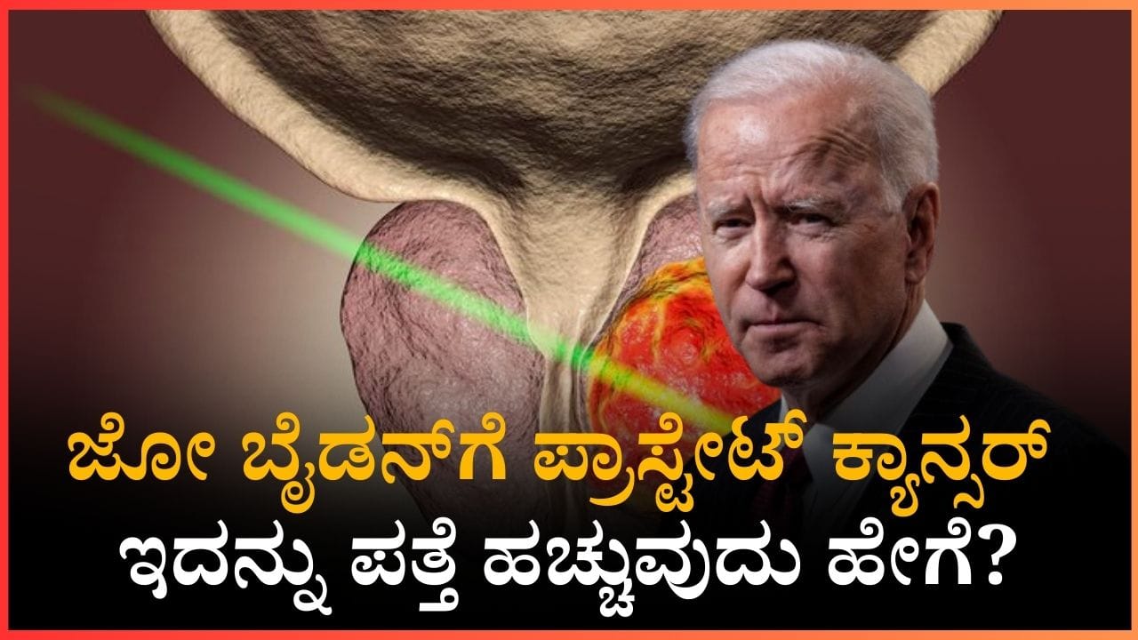 Prostate Cancer: ಪುರುಷರಲ್ಲಿ ಹೆಚ್ಚಾಗುತ್ತಿದೆ ಪ್ರಾಸ್ಟೇಟ್ ಕ್ಯಾನ್ಸರ್, ಏನಿದರ ಲಕ್ಷಣಗಳು? ತಡೆಯುವುದು ಹೇಗೆ? Prostate Cancer: ಪುರುಷರಲ್ಲಿ ಹೆಚ್ಚಾಗುತ್ತಿದೆ ಪ್ರಾಸ್ಟೇಟ್ ಕ್ಯಾನ್ಸರ್, ಏನಿದರ ಲಕ್ಷಣಗಳು? ತಡೆಯುವುದು ಹೇಗೆ?
