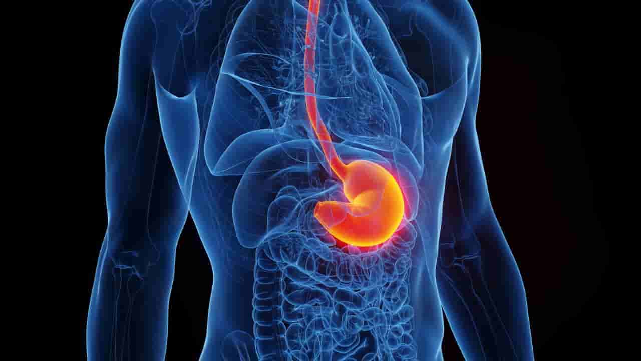 ಒಂದು ರೂಪಾಯಿ ಖರ್ಚಿಲ್ಲದೆ ಅಸಿಡಿಟಿ, ಎದೆಯುರಿ ಸಮಸ್ಯೆ ಕಡಿಮೆ ಮಾಡಬಹುದು, ಹೇಗೆ?