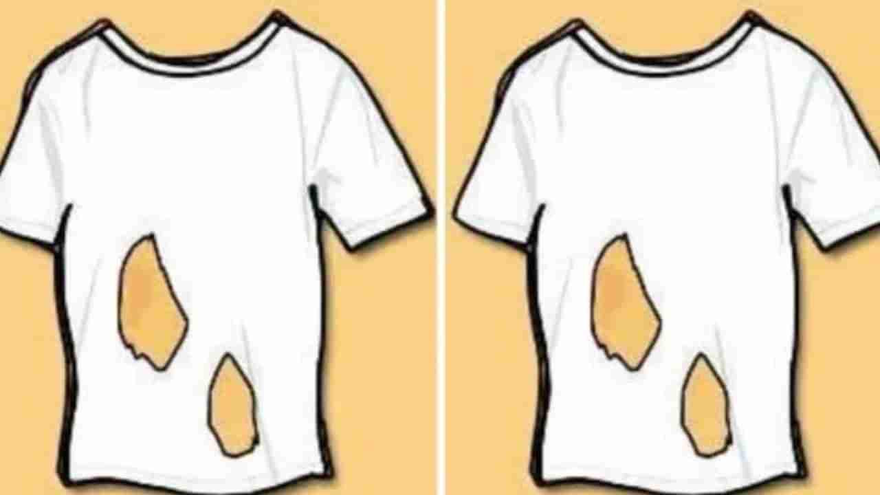 Brain Teaser : ಈ ಶರ್ಟ್‌ನಲ್ಲಿ ಎಷ್ಟು ತೂತುಗಳಿವೆ ಎಂದು ಹೇಳಿದ್ರೆ ನೀವು ಬುದ್ಧಿವಂತರು