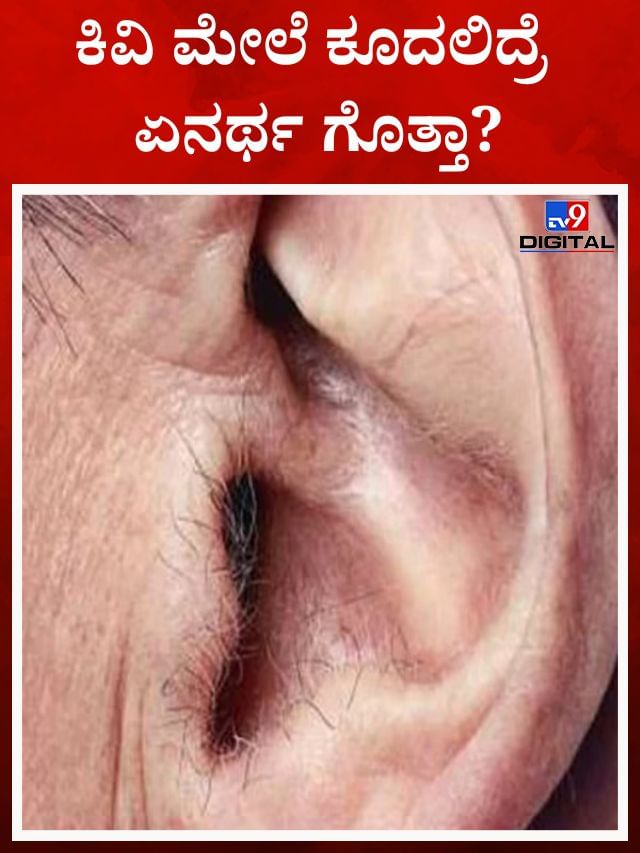 ಕಿವಿಯಲ್ಲಿ ಕೂದಲು ಬೆಳೆದ್ರೆ ಅದೃಷ್ಟವೇ?
