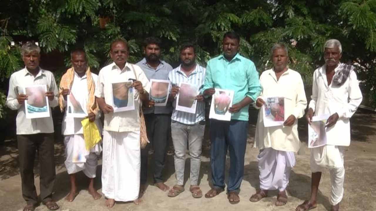 ಅಪ್ರಾಪ್ತ ಹುಡುಗಿಗೆ ಅಶ್ಲೀಲ ಮೆಸೇಜ್ ಆರೋಪ: 60 ಸವರ್ಣೀಯರಿಂದ ಮೂವರು ದಲಿತ ಯುವಕರ ಮೇಲೆ ಹಲ್ಲೆ ಅಪ್ರಾಪ್ತ ಹುಡುಗಿಗೆ ಅಶ್ಲೀಲ ಮೆಸೇಜ್ ಆರೋಪ: 60 ಸವರ್ಣೀಯರಿಂದ ಮೂವರು ದಲಿತ ಯುವಕರ ಮೇಲೆ ಹಲ್ಲೆ