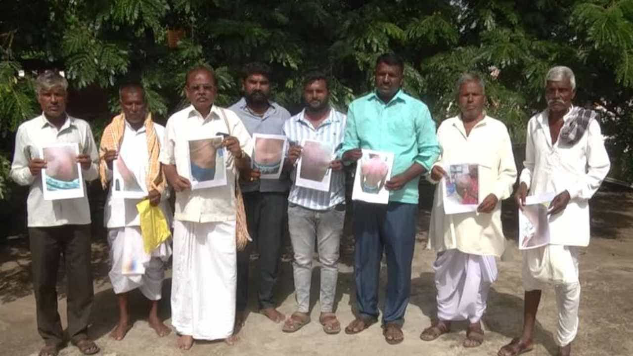 ಅಪ್ರಾಪ್ತ ಹುಡುಗಿಗೆ ಅಶ್ಲೀಲ ಮೆಸೇಜ್ ಆರೋಪ: 60 ಸವರ್ಣೀಯರಿಂದ ಮೂವರು ದಲಿತ ಯುವಕರ ಮೇಲೆ ಹಲ್ಲೆ ಅಪ್ರಾಪ್ತ ಹುಡುಗಿಗೆ ಅಶ್ಲೀಲ ಮೆಸೇಜ್ ಆರೋಪ: 60 ಸವರ್ಣೀಯರಿಂದ ಮೂವರು ದಲಿತ ಯುವಕರ ಮೇಲೆ ಹಲ್ಲೆ