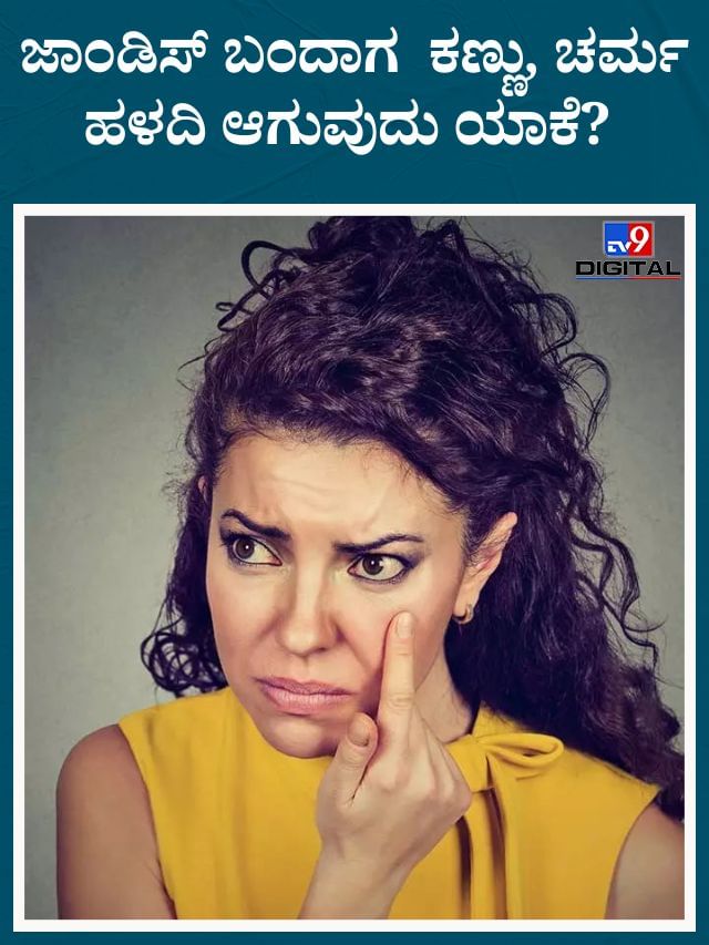 ಜಾಂಡಿಸ್ ಬಂದಾಗ ನಮ್ಮ ಕಣ್ಣು, ಚರ್ಮ ಹಳದಿಯಾಕಾಗುತ್ತೆ ಗೊತ್ತಾ?