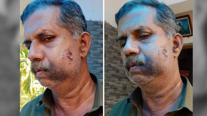 ನಾಲ್ಕನೇ ತರಗತಿಯಲ್ಲಿದ್ದಾಗ ಹೊಡೆದಿದ್ದಕ್ಕೆ ಈಗ ಸೇಡು ತೀರಿಸಿಕೊಂಡ ವ್ಯಕ್ತಿ ನಾಲ್ಕನೇ ತರಗತಿಯಲ್ಲಿದ್ದಾಗ ಹೊಡೆದಿದ್ದಕ್ಕೆ ಈಗ ಸೇಡು ತೀರಿಸಿಕೊಂಡ ವ್ಯಕ್ತಿ