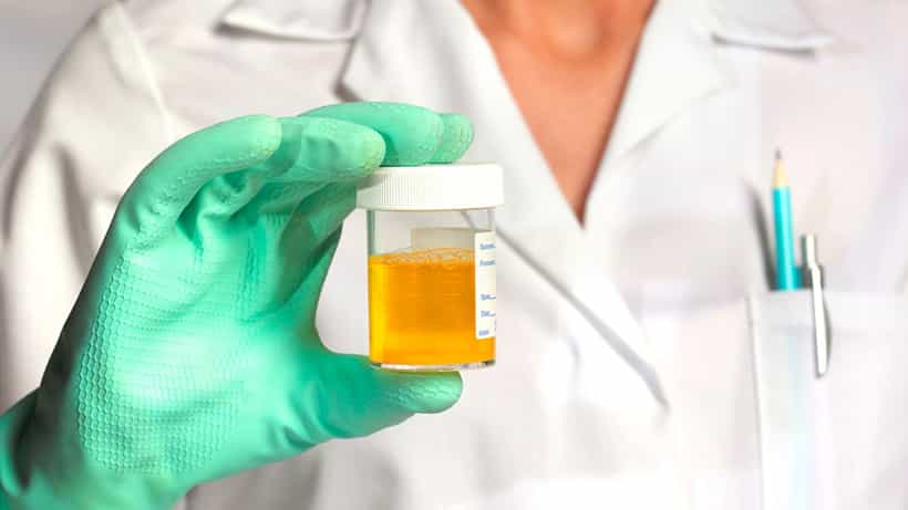 Foamy Urine: ನೀವು ಮೂತ್ರ ವಿಸರ್ಜನೆ ಮಾಡುವಾಗ ನೊರೆ ಬರುತ್ತಾ? ಇದು ಈ ಕಾಯಿಲೆಯ ಲಕ್ಷಣ