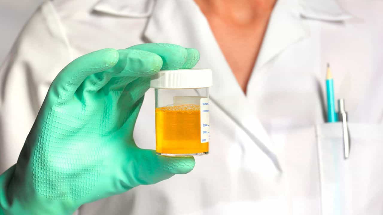 Foamy Urine: ನೀವು ಮೂತ್ರ ವಿಸರ್ಜನೆ ಮಾಡುವಾಗ ನೊರೆ ಬರುತ್ತಾ? ಇದು ಈ ಕಾಯಿಲೆಯ ಲಕ್ಷಣ Foamy Urine: ನೀವು ಮೂತ್ರ ವಿಸರ್ಜನೆ ಮಾಡುವಾಗ ನೊರೆ ಬರುತ್ತಾ? ಇದು ಈ ಕಾಯಿಲೆಯ ಲಕ್ಷಣ