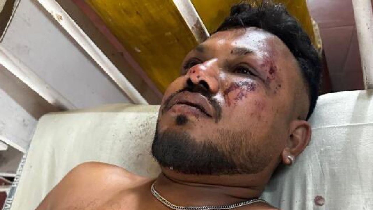 Ahmedabad Plane Crash: ವಿಮಾನ ಅಪಘಾತ; ಪವಾಡದಂತೆ ಜೀವ ಉಳಿಸಿಕೊಂಡ ಒಬ್ಬ ವ್ಯಕ್ತಿ!