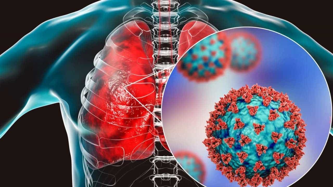 ಕೊರೊನಾ ಮಧ್ಯೆ Influenza, SARI ಕೇಸ್ಗಳು ಹೆಚ್ಚಳ! ಕೊರೊನಾ ಮಧ್ಯೆ Influenza, SARI ಕೇಸ್ಗಳು ಹೆಚ್ಚಳ!