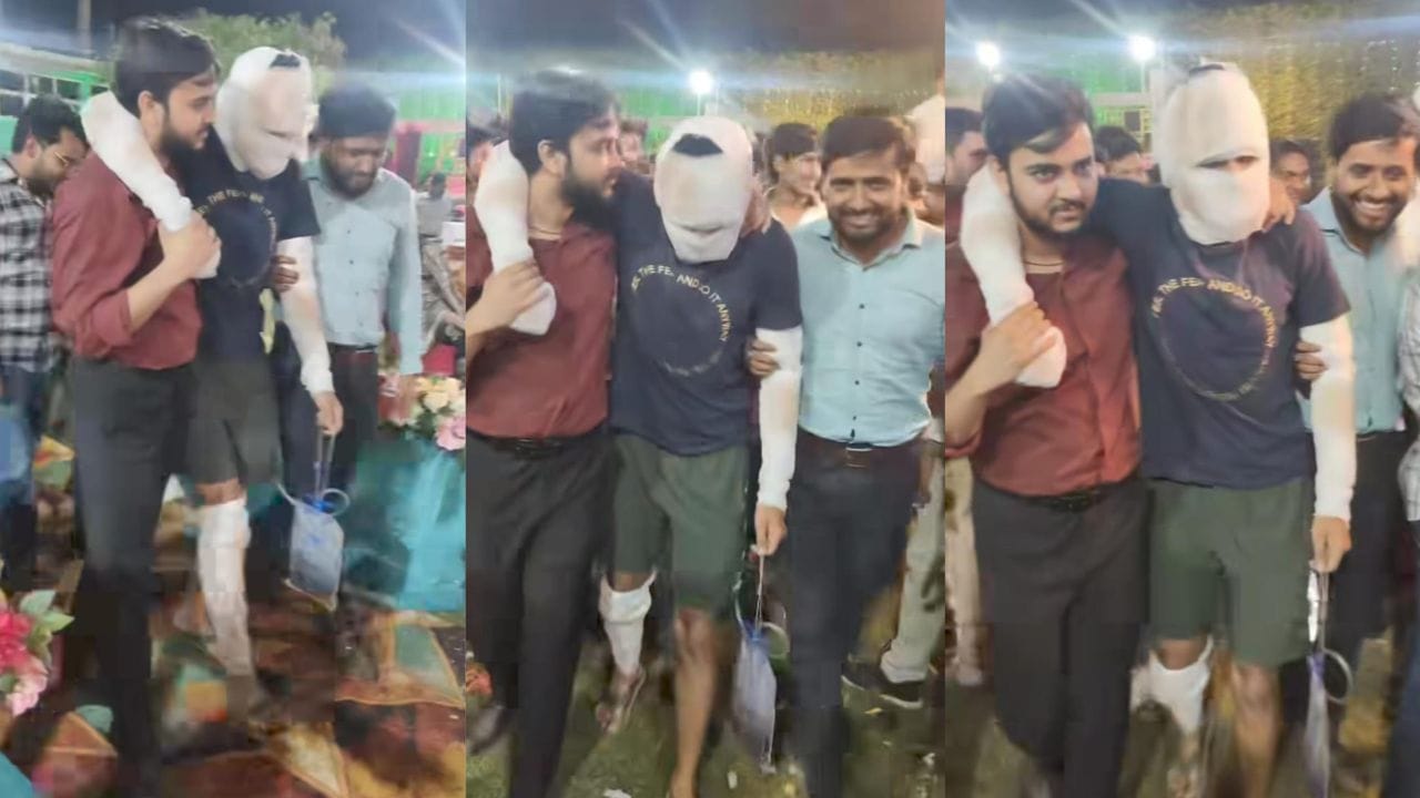 ಮುಖದ ತುಂಬಾ ಬ್ಯಾಂಡೇಜ್, ಪ್ಲಾಸ್ಟರ್, ಸ್ನೇಹಿತನ ಮದ್ವೆ ನೋಡಲು ಬಂದ ಜೀವದ ಗೆಳೆಯ ಮುಖದ ತುಂಬಾ ಬ್ಯಾಂಡೇಜ್, ಪ್ಲಾಸ್ಟರ್, ಸ್ನೇಹಿತನ ಮದ್ವೆ ನೋಡಲು ಬಂದ ಜೀವದ ಗೆಳೆಯ