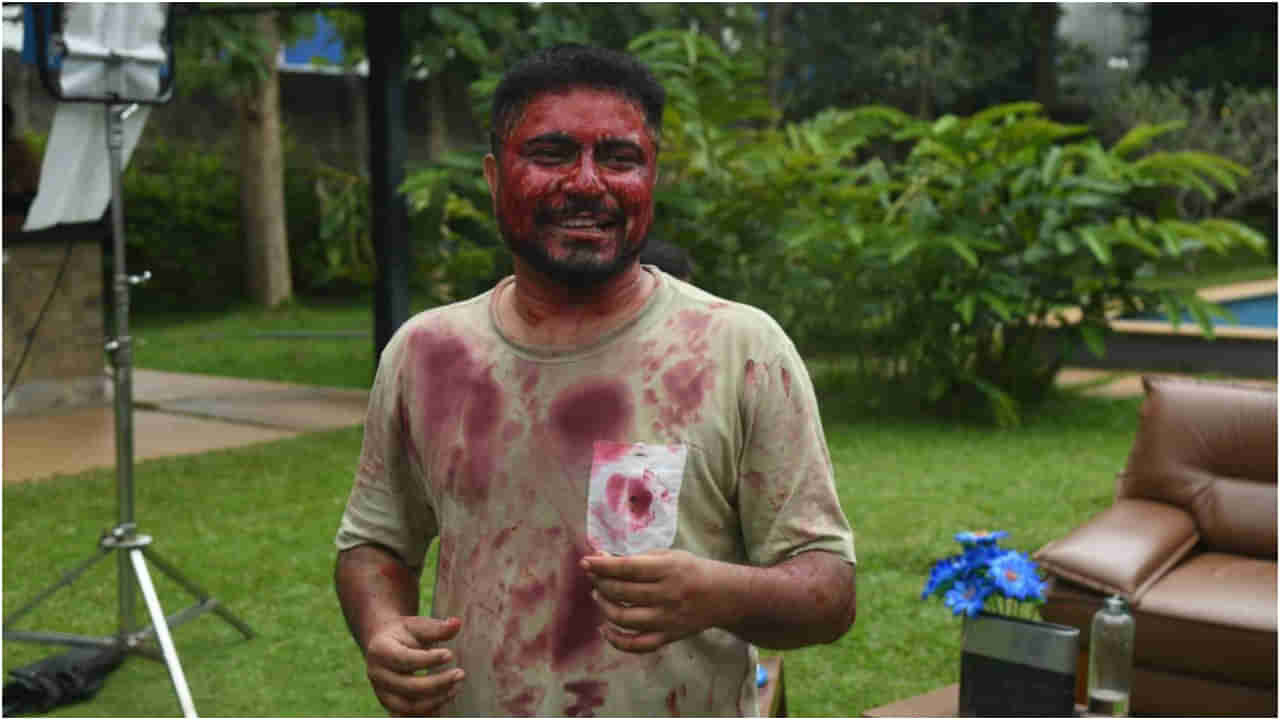 ಮಾಧ್ಯಮಗಳ ಎದುರು ನಟ ಪ್ರಥಮ್ ಈ ರೀತಿ ಕಾಣಿಸಿಕೊಂಡಿದ್ದು ಯಾಕೆ?