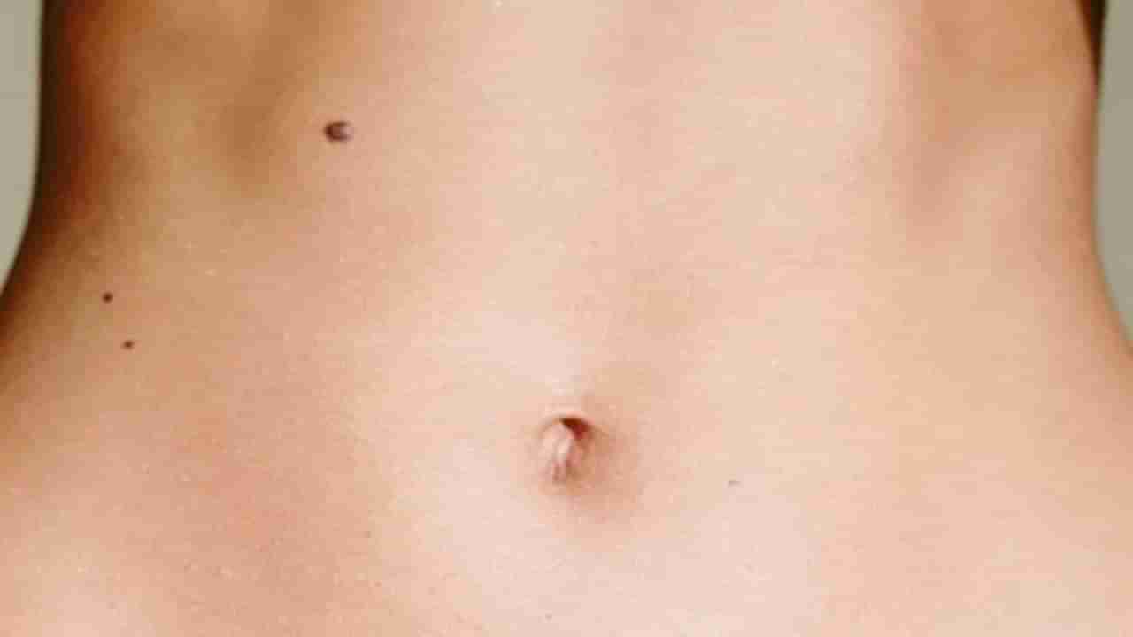 Belly Birthmarks: ಹೊಟ್ಟೆಯ ಈ ಭಾಗದಲ್ಲಿ ಮಚ್ಚೆ ಇದ್ದರೆ ನಿಮ್ಮಷ್ಟು ಅದೃಷ್ಟವಂತರು ಮತ್ಯಾರಿಲ್ಲ!