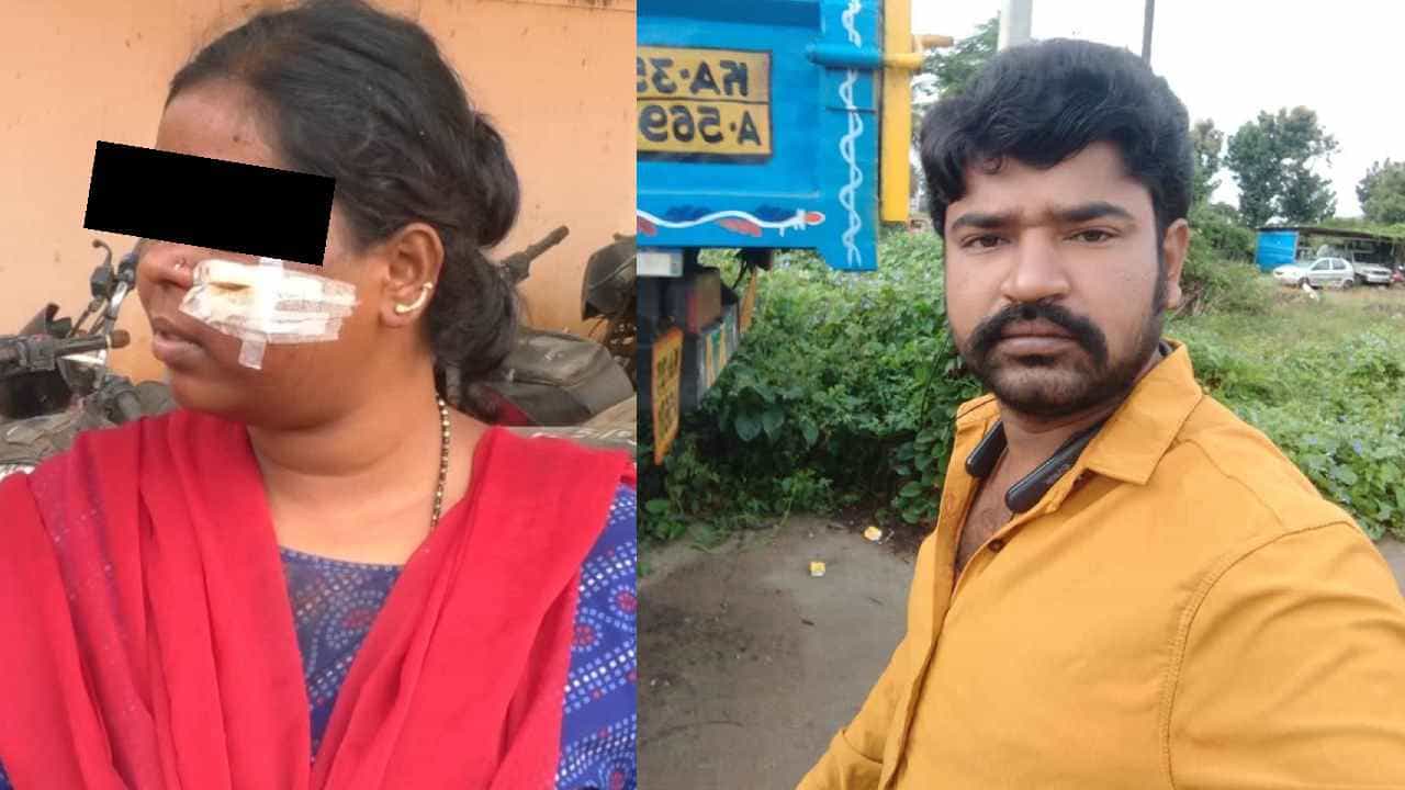 ಅನುಮಾನದ ಭೂತ: ಪತ್ನಿಯ ಮುಖವನ್ನು ಚಾಕುವಿನಿಂದ ವಿರೂಪಗೊಳಿಸಿದ ಪತಿ ಅನುಮಾನದ ಭೂತ: ಪತ್ನಿಯ ಮುಖವನ್ನು ಚಾಕುವಿನಿಂದ ವಿರೂಪಗೊಳಿಸಿದ ಪತಿ