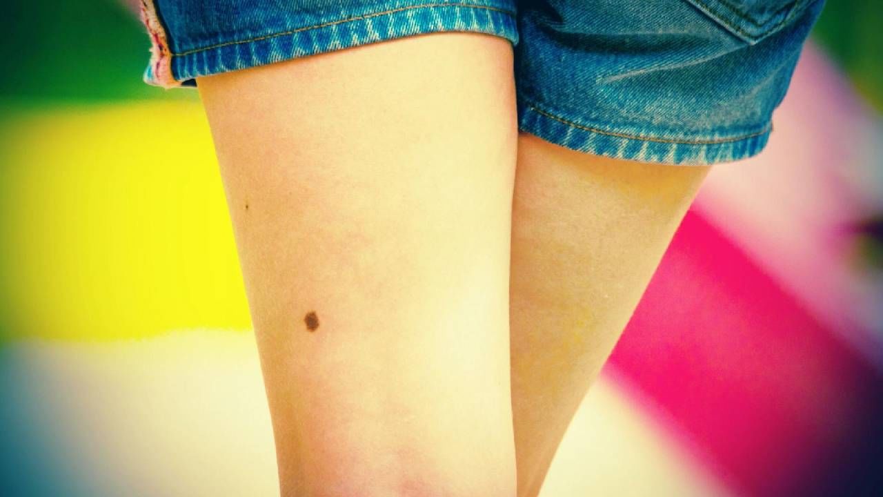 Samudrika Shastra: ಸಾಮುದ್ರಿಕಾ ಶಾಸ್ತ್ರದ ಪ್ರಕಾರ ಮೊಣಕಾಲಿನ ಮೇಲೆ ಮಚ್ಚೆಯಿದ್ದರೆ ಏನರ್ಥ? Samudrika Shastra: ಸಾಮುದ್ರಿಕಾ ಶಾಸ್ತ್ರದ ಪ್ರಕಾರ ಮೊಣಕಾಲಿನ ಮೇಲೆ ಮಚ್ಚೆಯಿದ್ದರೆ ಏನರ್ಥ?