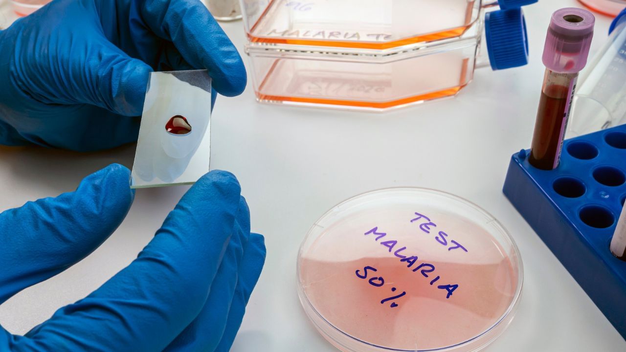 ಮಲೇರಿಯಾ ಸೋಂಕನ್ನು ತಡೆಯಲು ಬಂತು ಮೊದಲ ಲಸಿಕೆ! ಮಹಾಮಾರಿ ರೋಗದ ವಿರುದ್ಧ ಮಹತ್ವದ ಹೆಜ್ಜೆ