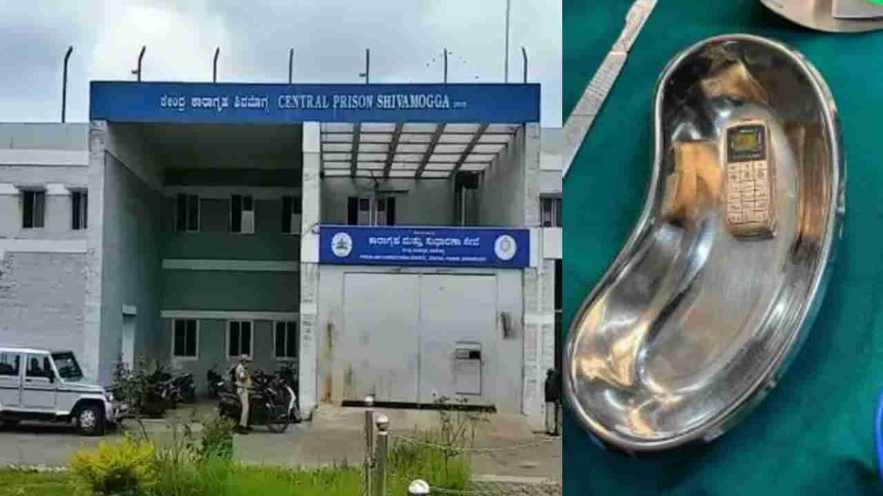 ಶಾಕಿಂಗ್: ಖೈದಿ ಹೊಟ್ಟೆಯಲ್ಲಿ ಮೊಬೈಲ್ ಪತ್ತೆ, ಆಪರೇಷನ್ ಮಾಡಿ ಹೊರತೆಗೆದ ವೈದ್ಯರು
