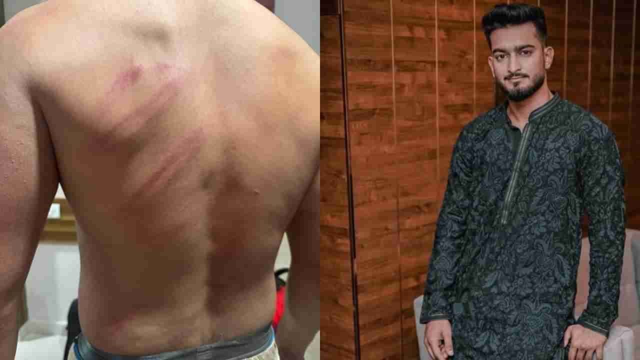 ಕ್ಷುಲ್ಲಕ ಕಾರಣಕ್ಕೆ ಕಿರಿಕ್: ರಾಡು, ದೊಣ್ಣೆಯಿಂದ ಮಾಡೆಲ್ ಮೇಲೆ ಬಸ್ ಸಿಬ್ಬಂದಿ ಹಲ್ಲೆ